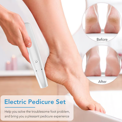 60%off🔥Last Day Special Price £16.99!!💥-🎁Portable Electric Feet Callus Remover (Copy)