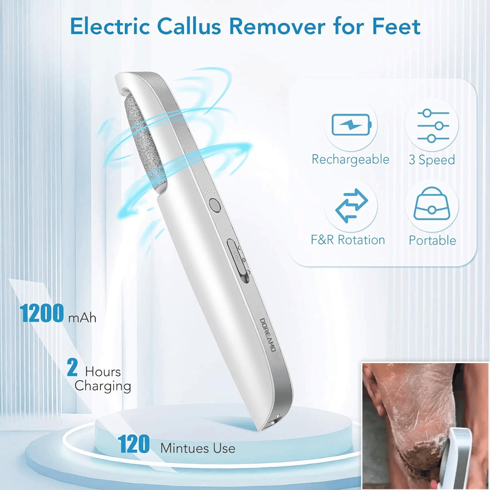 🎁Portable Electric Feet Callus Remover
