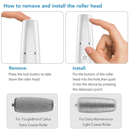 60%off🔥Last Day Special Price £16.99!!💥-🎁Portable Electric Feet Callus Remover (Copy)
