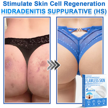 🎁 Celsiora® 2-in-1 Microneedle & Hydrocolloid Patch | Raised Moles,Acne,  Flat Warts & Skin Tags Remover | Improves Wrinkles, Scars & Blemishes | Invisible Star Pimple Patches for Face & Body