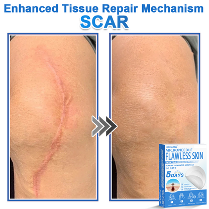 ⏳Celsiora® 2-in-1 Microneedle & Hydrocolloid Patch | Raised Moles,Acne,  Flat Warts & Skin Tags Remover | Improves Wrinkles, Scars & Blemishes | Invisible Star Pimple Patches for Face & Body