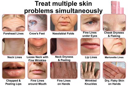 upsell-🥳60% OFF | Today Only!🥳💕PDRN Pink Collagen Volume Multi Balm | All In One Volufiline, PDRN, NAD Stick for Youthful-Looking
