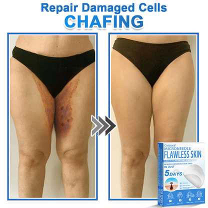 👩‍⚕️ Celsiora® 2-in-1 Microneedle & Hydrocolloid Patch | Raised Moles,Acne,  Flat Warts & Skin Tags Remover | Improves Wrinkles, Scars & Blemishes | Invisible Star Pimple Patches for Face & Body