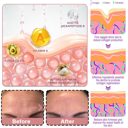 upsell-🥳60% OFF | Today Only!🥳💕PDRN Pink Collagen Volume Multi Balm | All In One Volufiline, PDRN, NAD Stick for Youthful-Looking