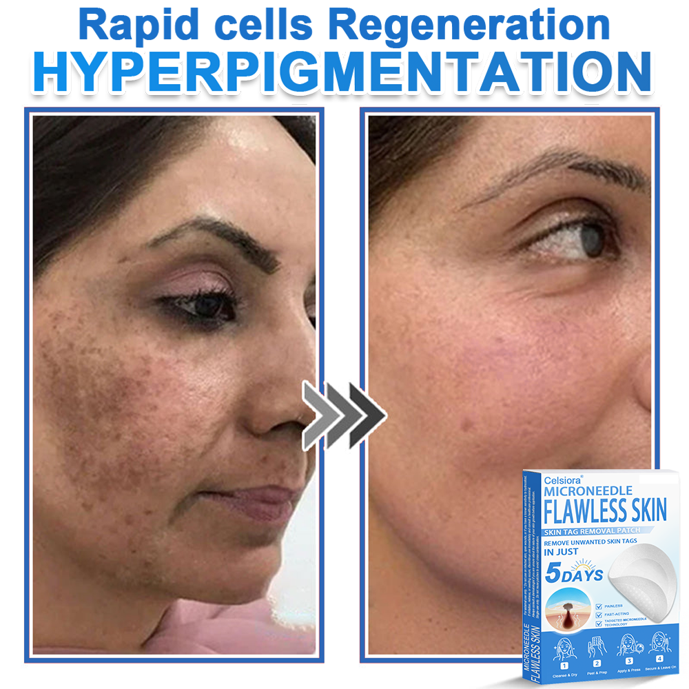 🔥 Celsiora® 2-in-1 Microneedle & Hydrocolloid Patch | Raised Moles,Acne,  Flat Warts & Skin Tags Remover | Improves Wrinkles, Scars & Blemishes | Invisible Star Pimple Patches for Face & Body