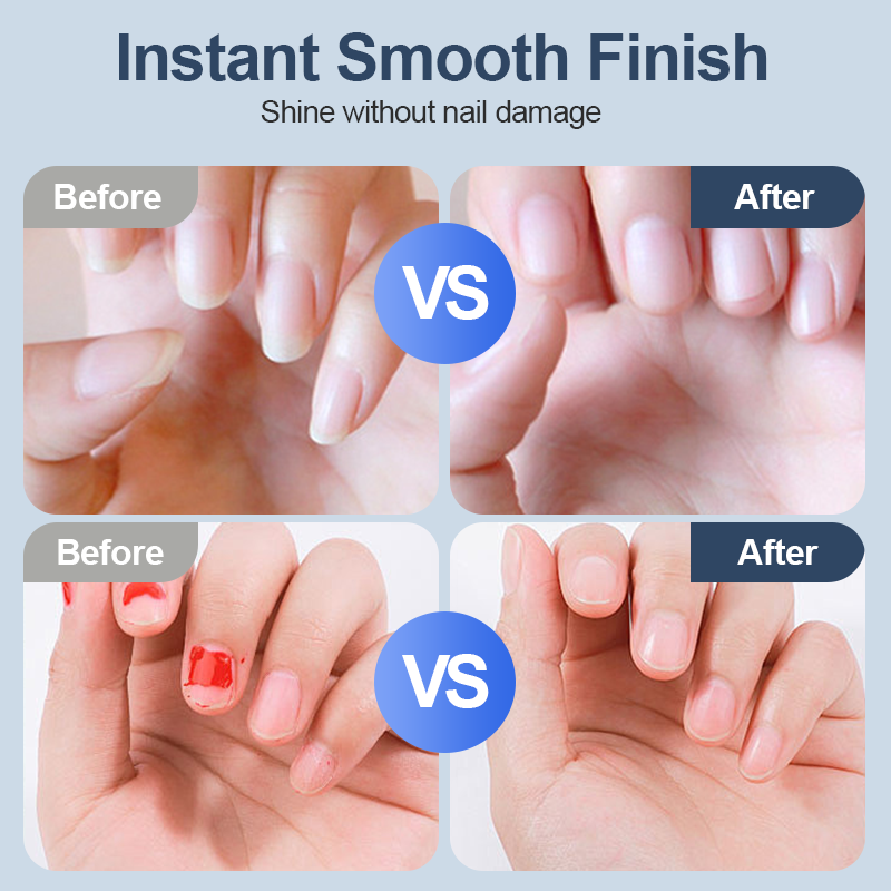 🔥Universal Automatic Fingernail Grinder for Adults and Children -Remifa®